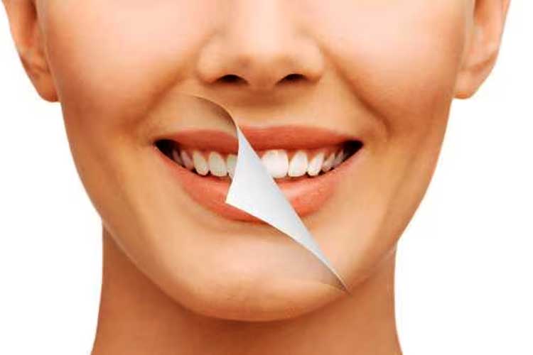 How to Restore Natural White Teeth Safely and Naturally
