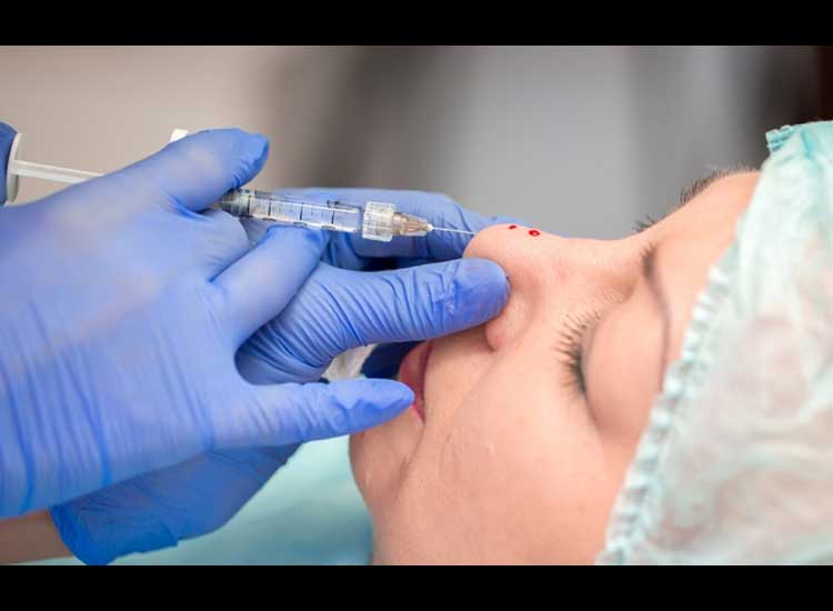 Get to know the procedures, benefits and side effects of nasal filler injections