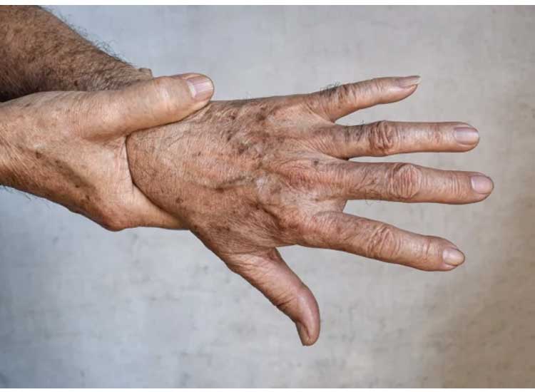 5 Causes of Black Spots on Hands, Plus Solutions to Remove Them